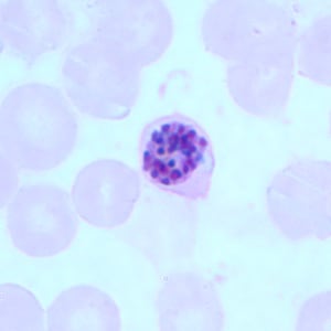 Figure A: Schizont of <em>P. falciparum</em> in a thin blood smear.
