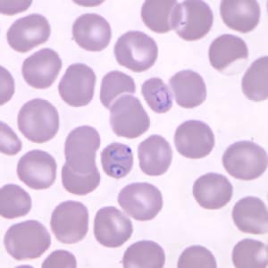 Figure A: Ring-form trophozoites of <em>P. knowlesi</em> in a Giemsa-stained thin blood smear from a human patient that traveled to the Philippines. Note a multiply-infected RBC in this image. Image courtesy of the Wadsworth Center, New York State Department of Health.