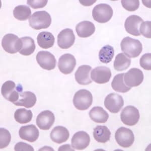 Figure C: Ring-form trophozoites of <em>P. knowlesi</em> in a Giemsa-stained thin blood smear from a human patient that traveled to the Philippines. Note a multiply-infected RBC in this image. Image courtesy of the Wadsworth Center, New York State Department of Health.
