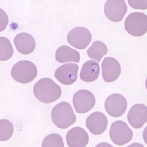 Figure D: Ring-form trophozoites of <em>P. knowlesi</em> in a Giemsa-stained thin blood smear from a human patient that traveled to the Philippines. Image courtesy of the Wadsworth Center, New York State Department of Health.