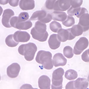 Figure E: Ring-form trophozoites of <em>P. knowlesi</em> in a Giemsa-stained thin blood smear from a human patient that traveled to the Philippines. Image courtesy of the Wadsworth Center, New York State Department of Health.