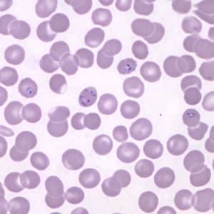Figure F: Ring-form trophozoites of <em>P. knowlesi</em> in a Giemsa-stained thin blood smear from a human patient that traveled to the Philippines. Note a multiply-infected RBC in this image. Image courtesy of the Wadsworth Center, New York State Department of Health.