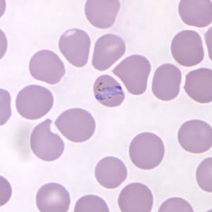 Figure A: Band-form trophozoite of <em>P. knowlesi</em> in a Giemsa-stained thin blood smear from a human patient that traveled to the Philippines. Image courtesy of the Wadsworth Center, New York State Department of Health.