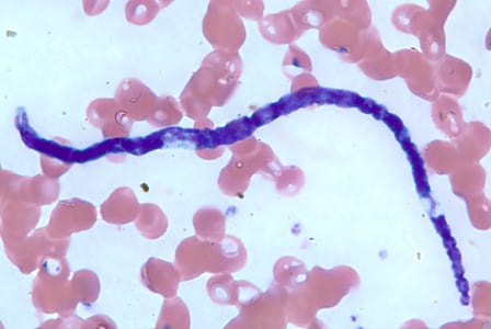 Figure D: Microfilaria of <em>M. perstans</em> in a thin blood smear from the same specimen as Figures A-C.