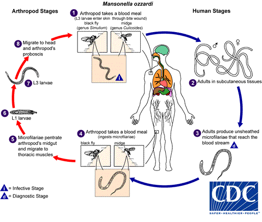 how fever control DPDx  Mansonellosis  CDC how fever control DPDx  Mansonellosis  CDC