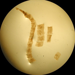 Figure A: Proglottids of <em>Mesocestoides</em> sp., collected from the stool of a dog.