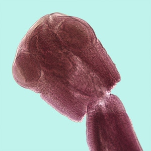Figure E: Scolex of <em>Mesocestoides</em> sp. stained with carmine. In this field, two of the suckers are clearly visible. Note that lack of rostellar hooklets. 