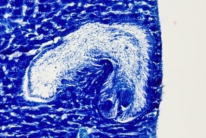 Figure A: Tetrathyridium of <em>Mesocestoides</em> sp. in the liver of a laboratory-infected mouse, Giemsa stain. 100x magnification.