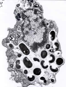 Figure B: Electron micrograph of an eukaryotic cell with <em>Encephalitozoon intestinalis</em> spores and developing forms inside a septated parasitophorous vacuole. The vacuole is a characteristic feature of this microsporidian species.