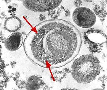 Figure C: Electron micrograph of an <em>Enterocytozoon bieneusi</em> spore. Arrows indicate the double rows of polar tubule coils in cross section which characterize a mature E. bieneusi spore.