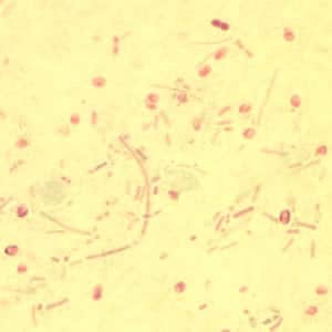Figure D: <em>Enterocytozoon bieneusi</em> spores stained with Chromotrope 2R.