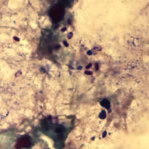 Figure C: <em>Encephalitozoon cuniculi</em> spores stained with Gram Chromotrope.