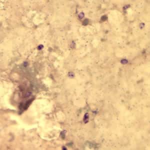 Figure A: <em>Encephalitozoon cuniculi</em> spores stained with Gram Chromotrope.
