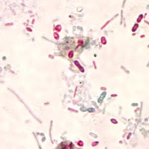 Figure E: Unidentified microsporidia stained with Chromotrope 2R.