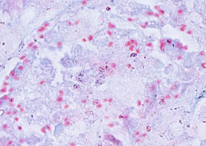 Figure D: Spores of <em>E. cuniculi</em> in a kidney biopsy specimen stained with Ryan's modified trichrome.
