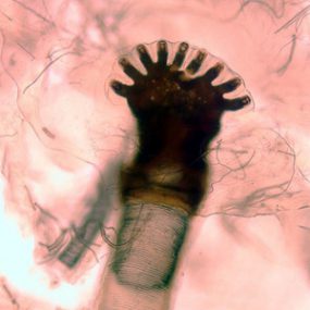 CDC - DPDx - Myiasis