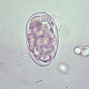 Figure B: Egg of <em>Oesophagostomum</em> sp. in an unstained wet mount of stool.