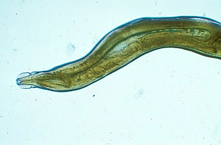 Figure A: Adult of <em>Oesophagostomum</em> sp.