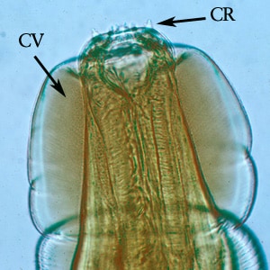 Figure C: Higher magnification of the anterior end of the specimen in Figures A and B. Note the presence of the cephalic vesicle (CV) and corona radiata (CR).