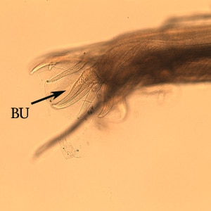 Figure F: Same specimen as in Figure E, but shown in a slightly different focal plane. Note the bursa (BU).