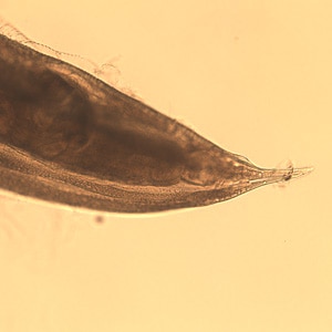 Figure D: Posterior end of a female <em>Oesophagostomum</em> sp., showing the pointed tail.