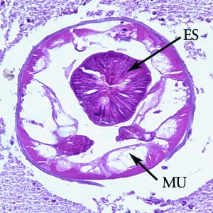 Figure C: Higher-magnification (200x) of the specimen in Figure A. Note the large, platymyarian muscle cells (MU) and thick, muscled esophagus (ES).