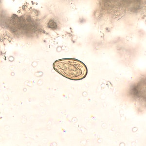 Figure B: Egg of <em>O. viverrini</em> in an unstained wet mount of concentrated stool. Image taken at 400x magnification