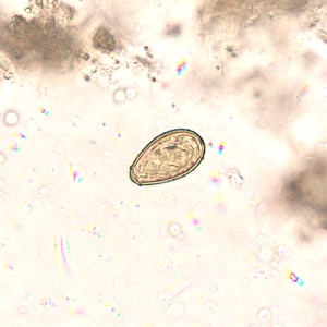 Figure C: Egg of <em>O. viverrini</em> in an unstained wet mount of concentrated stool. Image taken at 400x magnification.