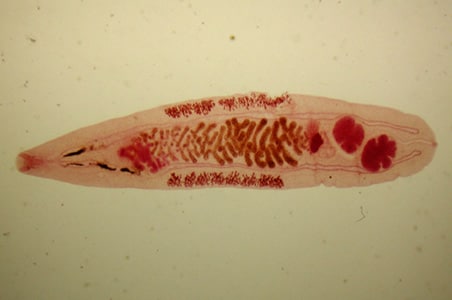 Figure A: Adult of <em>O. felineus</em>. Image courtesy of the Web Atlas of Medical Parasitology and the Korean Society for Parasitology.