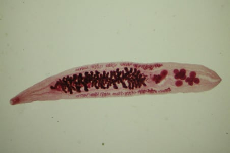 Minden az opisthorchia parazitáiról - Pinworms ragadós szalagon