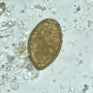 Figure D: Egg of <em>P. westermani</em> in an unstained wet mount.