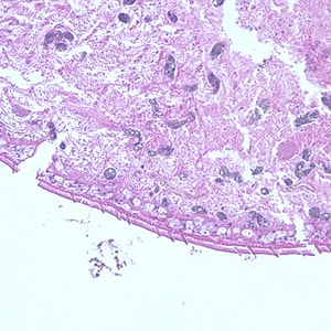 Figure D: Higher magnification of Figure C, showing a close-up of the cuticle. 
