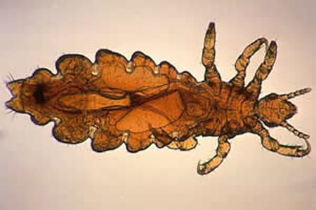 Figure B: Adult female of <em>P. humanus capitis</em>. In this specimen, eggs can be observed in the abdomen.