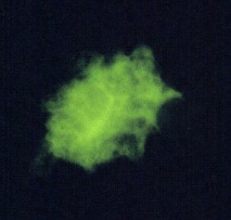 Figure A: Indirect immunofluorescence using monoclonal antibodies against <em>Pneumocystis jirovecii</em>.