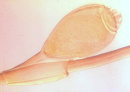 Figure A: Egg (nit) of <em>P. pubis</em>.