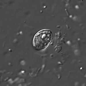Figure B: Individual sporocyst of <em>Sarcocystis</em> sp. in a wet mount viewed under DIC microscopy, magnification 400x.