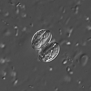 Figure C: Sporulated oocyst of <em>Sarcocystis</em> sp. in a wet mount viewed under DIC microscopy, magnification 400x.