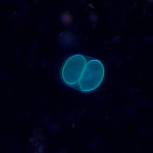 Figure A: Sporulated oocyst of <em>Sarcocystis</em> sp. in a wet mount viewed under UV microscopy, magnification 400x.