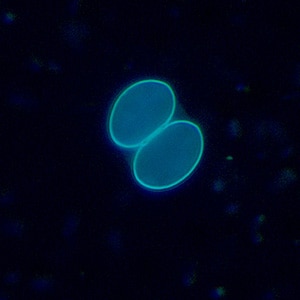 Figure B: Sporulated oocyst of <em>Sarcocystis</em> sp. in a wet mount viewed under UV microscopy, magnification 400x.