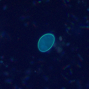 Figure C: Individual sporocyst of <em>Sarcocystis</em> sp. in a wet mount viewed under UV microscopy, magnification 400x.