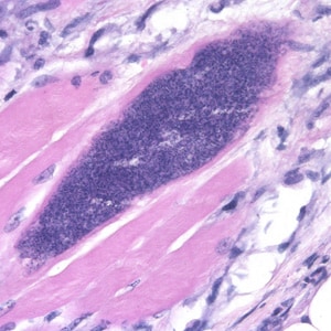 Figure E: Sarcocyst of <em>Sarcocystis</em> sp. in muscle tissue, stained with H&E (magnification 500x).