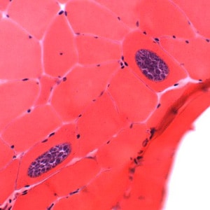 Figure B: Sarcocysts of <em>Sarcocystis</em> sp. in muscle tissue, stained with hematoxylin and eosin (H&E). Notice the bradyzoites within each sarcocyst. Images courtesy of the William Beaumont Hospital, Royal Oak, MI.