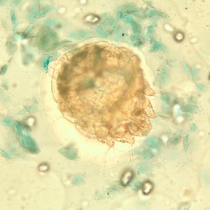 Figure B: <em>Sarcoptes scabiei</em> mite in a skin scraping, stained with lactophenol cotton-blue.