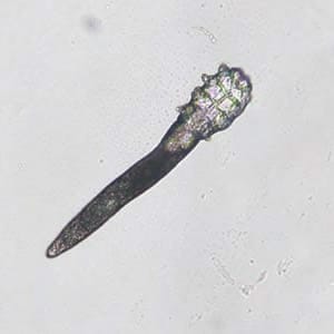 Figure A: Adult <em>Demodex</em> mite. Image courtesy of Dr. CSBR Prasad, Vindhya Clinic and Diagnostic Lab, India.