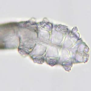 Figure B: Close-up of the anterior end of the mite in Figure A, showing the mouthparts (gnathosoma) and legs (podosoma).