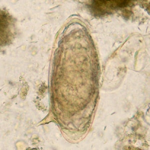paraziták hematobium schistosome a hpv ok a hímeknél