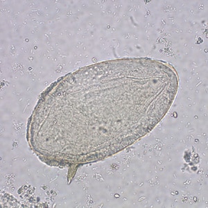 Figure C: Egg of <em>S. mansoni</em> in an unstained wet mount. Images courtesy of the Missouri State Public Health Laboratory.
