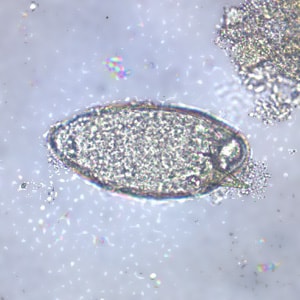 Figure A: Egg of <em>S. mansoni</em> in an unstained wet mount. Images courtesy of the Wisconsin State Laboratory of Hygiene.