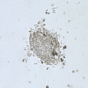 Figure A: Egg of <em>S. haematobium</em> in a wet mount of urine concentrates, showing the characteristic terminal spine.