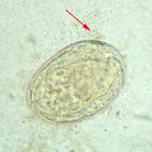 Figure B: Egg of <em>S. japonicum</em> in an unstained wet mount. Note the small, inconspicuous spines (red arrows).